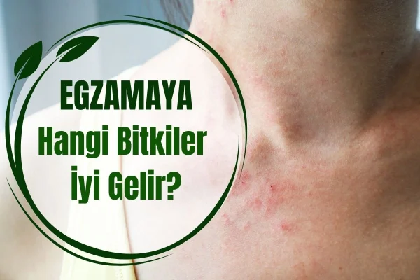 Egzamaya Hangi Bitkiler İyi Gelir